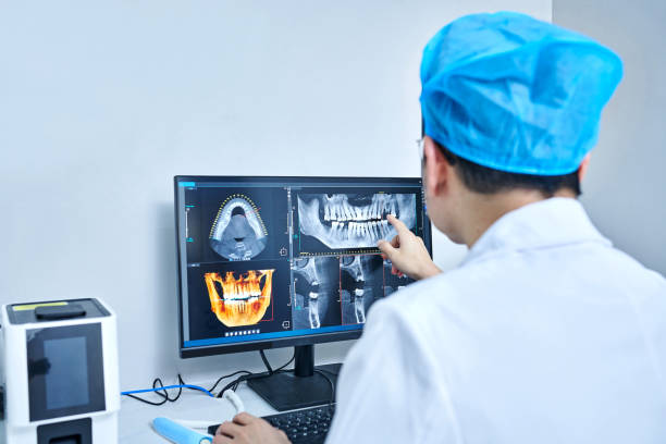 Best Knocked-Out Tooth (Avulsed Tooth) Treatment in Fargo, ND